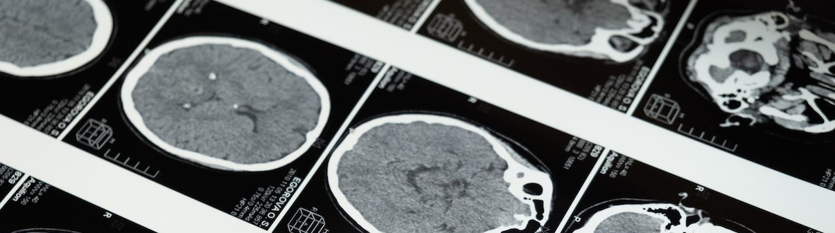 Conoce la Estructura física del Cerebro